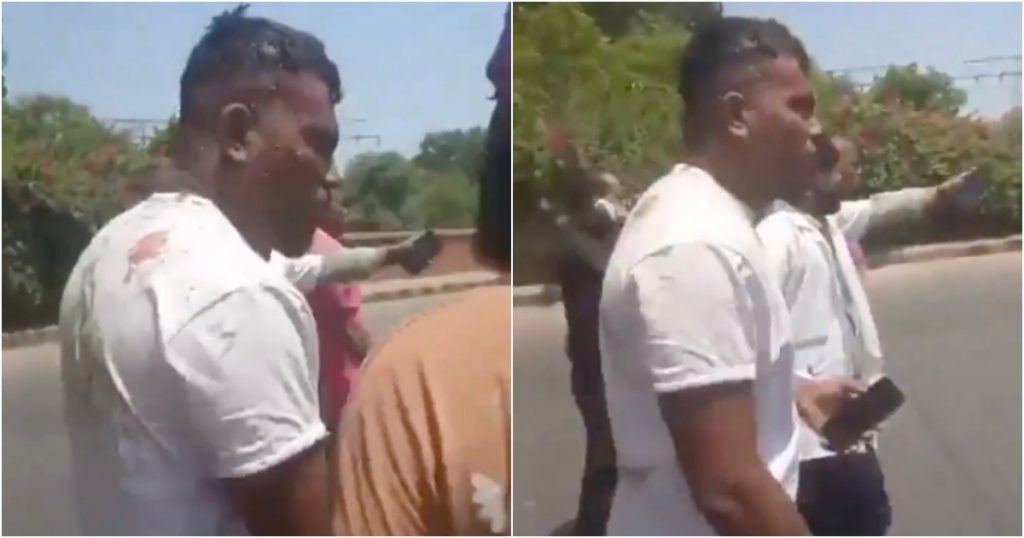 Miracle Amid Tragedy: British Man Survives Air India Flight 171 Crash with Minor Injuries; 241 Perish