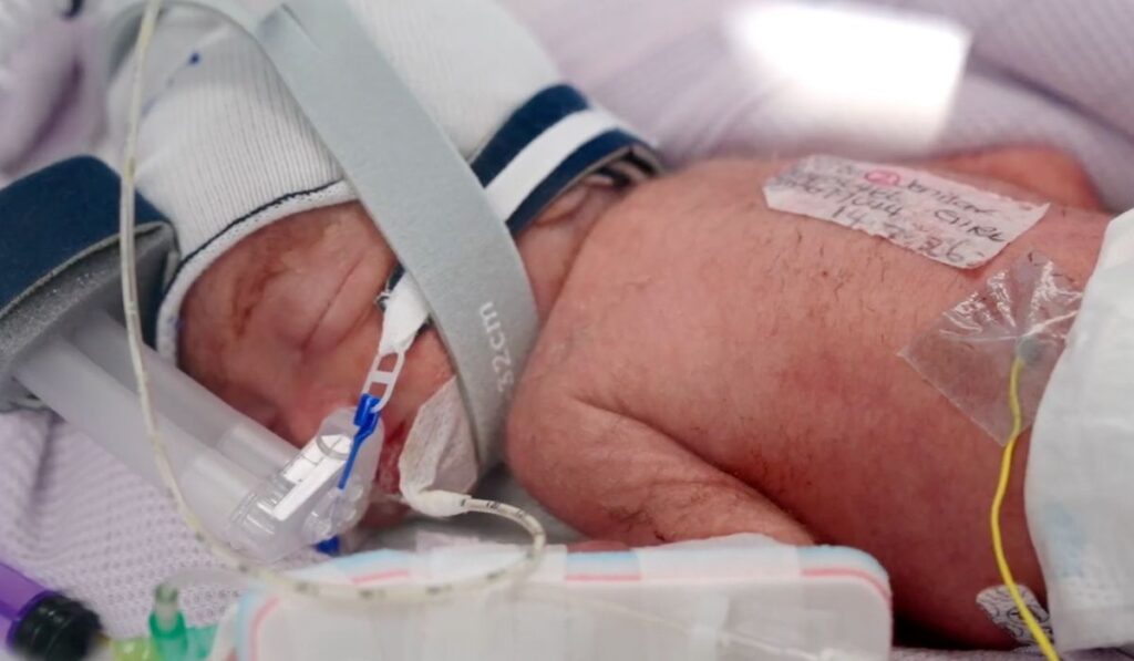 Australian Woman Gives Birth to Identical Quadruplet Girls